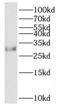 GID8 Antibody