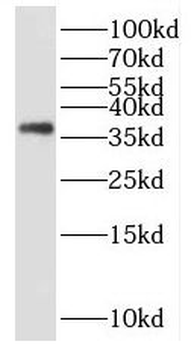 FNDC11 Antibody