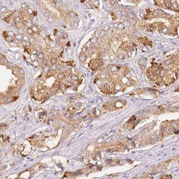 FNDC11 Antibody