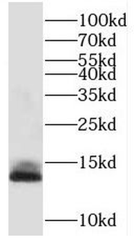 TMEM230 Antibody
