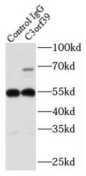 POMGNT2 Antibody