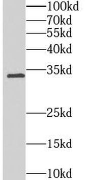MGARP Antibody