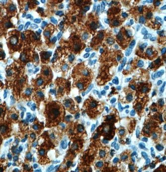 MGARP Antibody