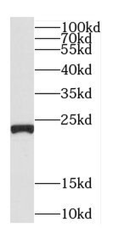 C5orf24 Antibody