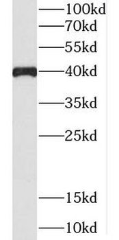 FAXDC2 Rabbit Polyclonal Antibody