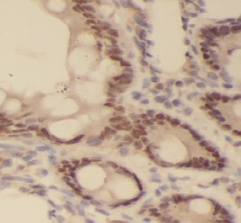 FAXDC2 Rabbit Polyclonal Antibody