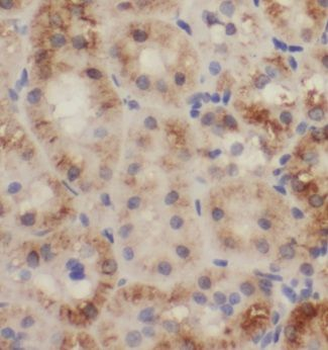 TRAPPC13 Antibody