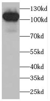 C6 Rabbit Polyclonal Antibody