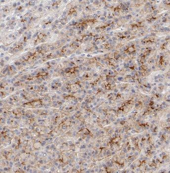 C6 Rabbit Polyclonal Antibody