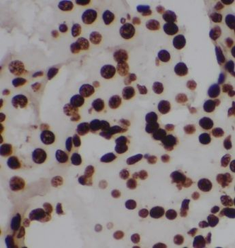 OARD1 Antibody
