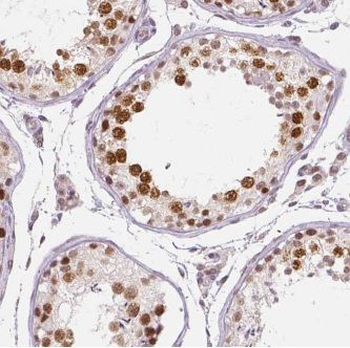ARMT1 Antibody
