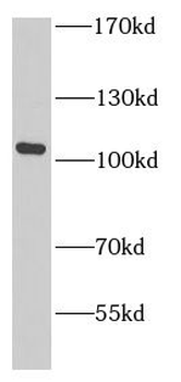 C7 Rabbit Polyclonal Antibody