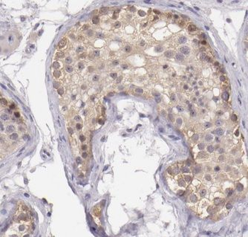MALSU1 Antibody