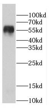 TTI2 Antibody