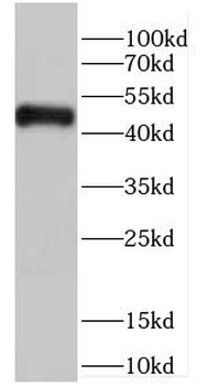 CARNMT1 Rabbit Polyclonal Antibody