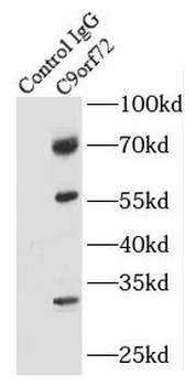 C9orf72 Antibody
