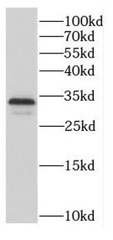 C9orf78 Antibody