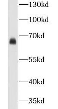 CA9 Antibody