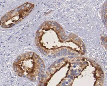 CA9 Antibody