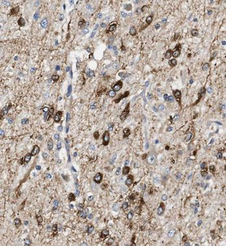 CA10 Antibody