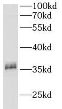 CA11 Antibody