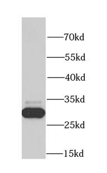 CA3 Rabbit Polyclonal Antibody
