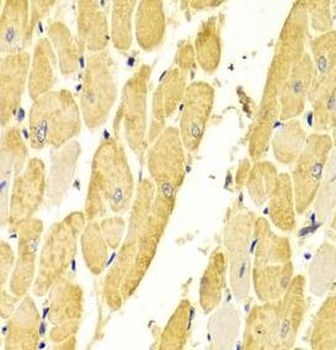 CA3 Rabbit Polyclonal Antibody