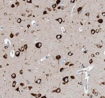 CACNA1B Antibody