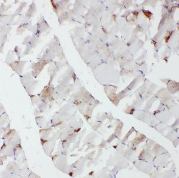 CACNA1S Antibody