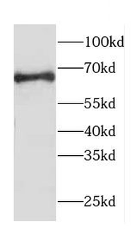 CACNB1 Antibody