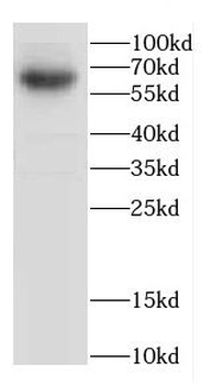 CACNB4 Antibody