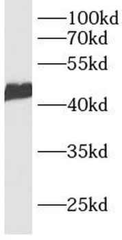 CACNG7 Rabbit Polyclonal Antibody