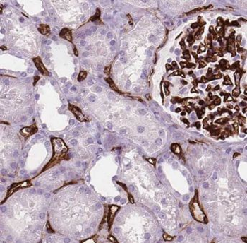 CDH16 Antibody