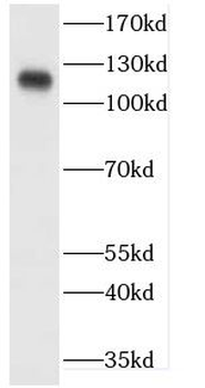 CDH20 Rabbit Polyclonal Antibody