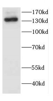 CASR Antibody
