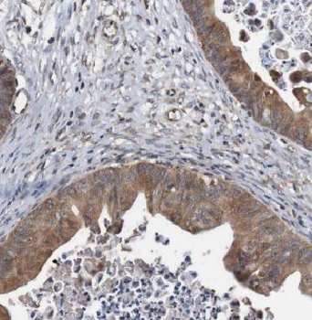 CALCOCO2 Antibody