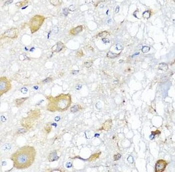 CALHM1 Antibody