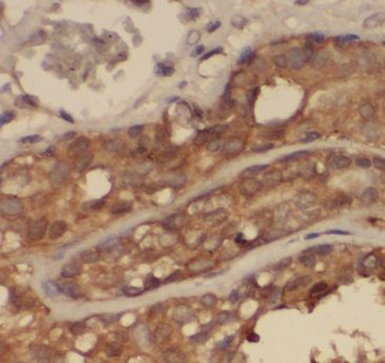 CALM3 Antibody