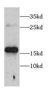 CALM2 Rabbit Polyclonal Antibody