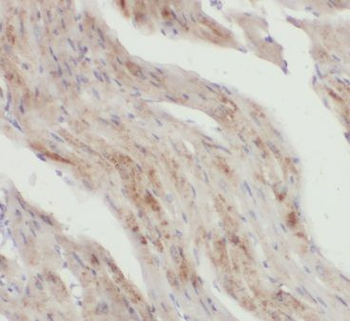 CALM2 Rabbit Polyclonal Antibody