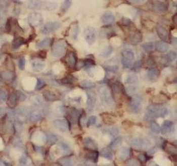 CANX Antibody