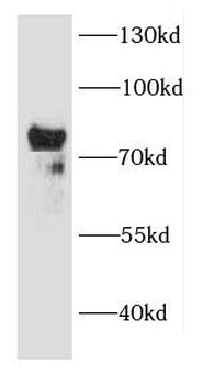 CAPN2 Rabbit Polyclonal Antibody