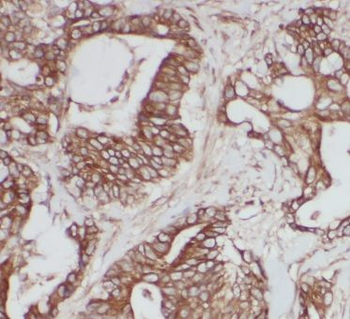 CAPN2 Rabbit Polyclonal Antibody