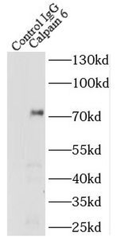 CAPN6 Antibody