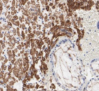 CAPN6 Antibody