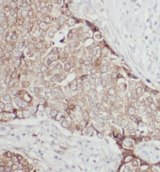 CAST Antibody