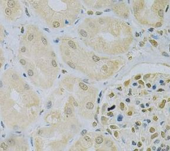 CAMK1D Antibody