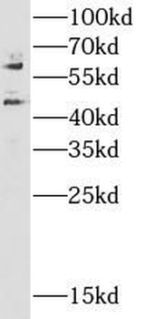 CAMK2A Rabbit Polyclonal Antibody