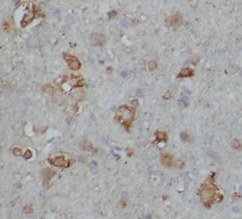 CAMK2A Rabbit Polyclonal Antibody
