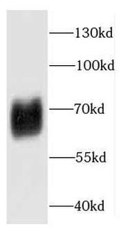 CAMK4 Rabbit Polyclonal Antibody